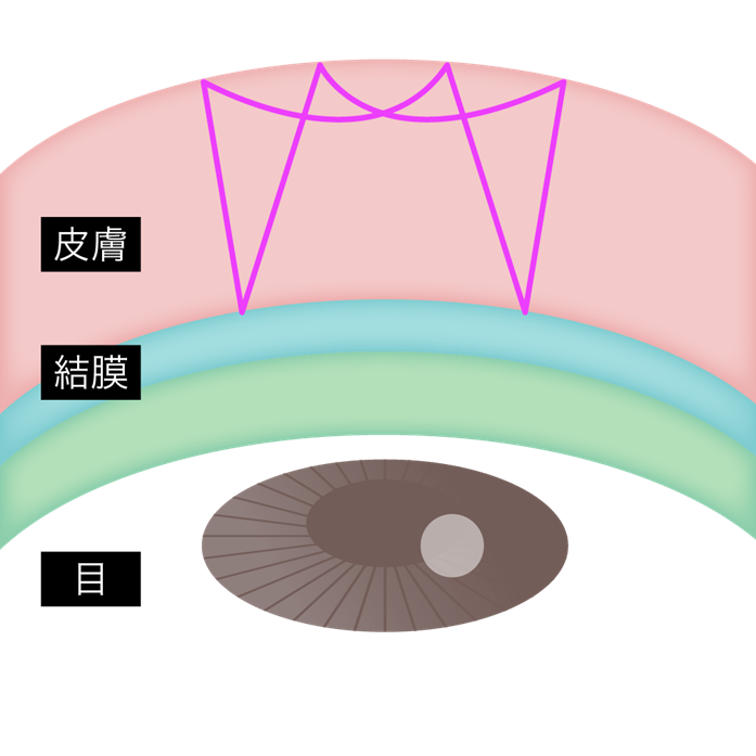 Flora Loop