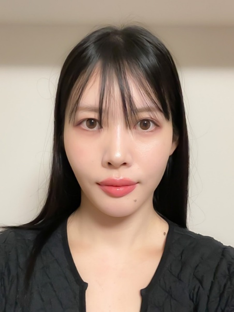 Front view photo of the face immediately after treatment