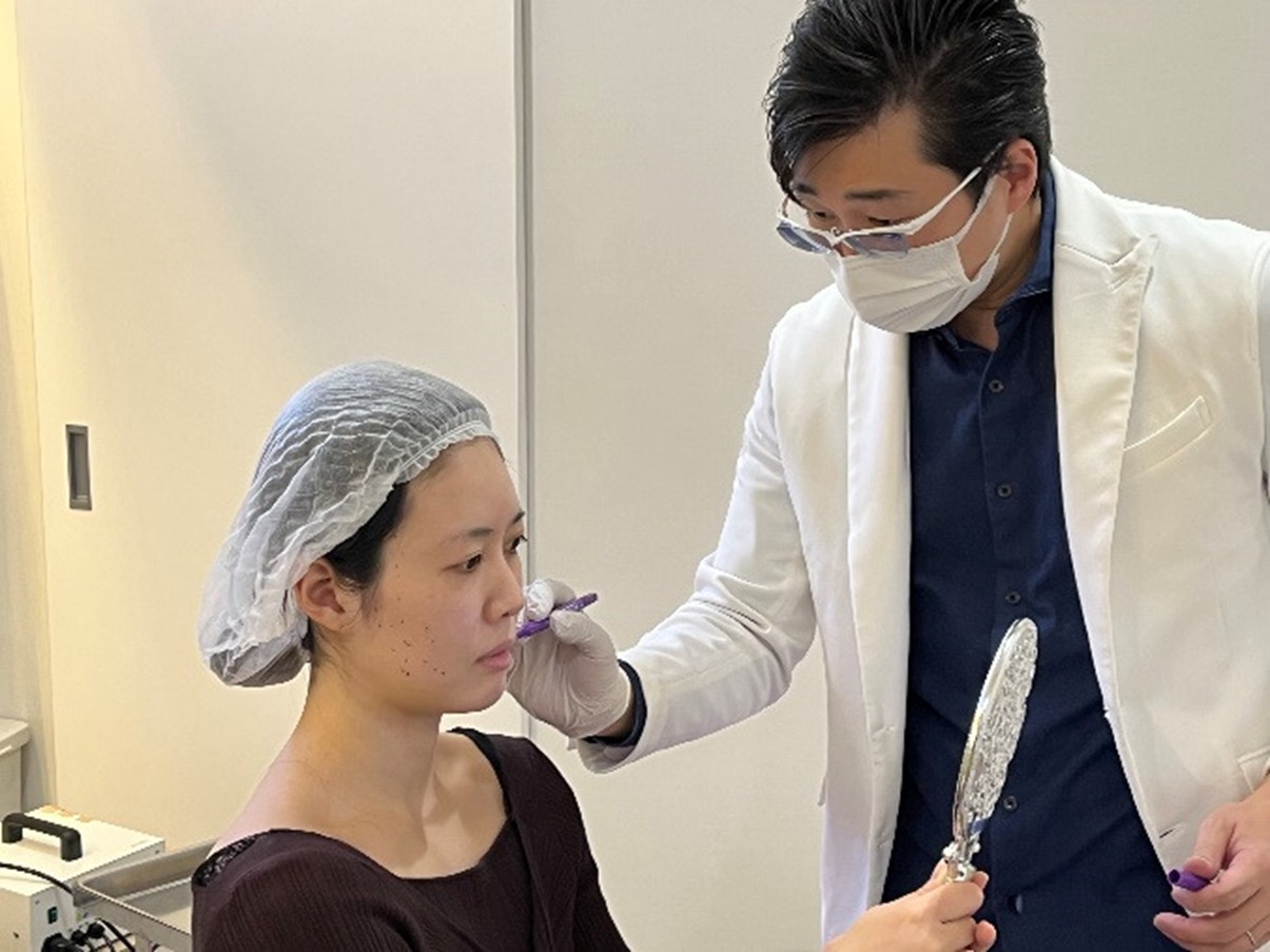 Marking Immediately Before Thread Lift Procedure