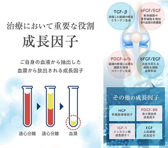 PDF-FD Therapy Growth Factors